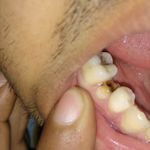 Aditya04