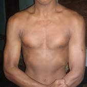 Moi