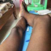 Bedeki
